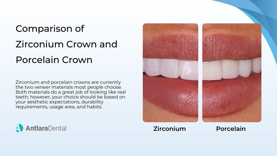 Slide comparing smiles with zirconium and porcelain crowns