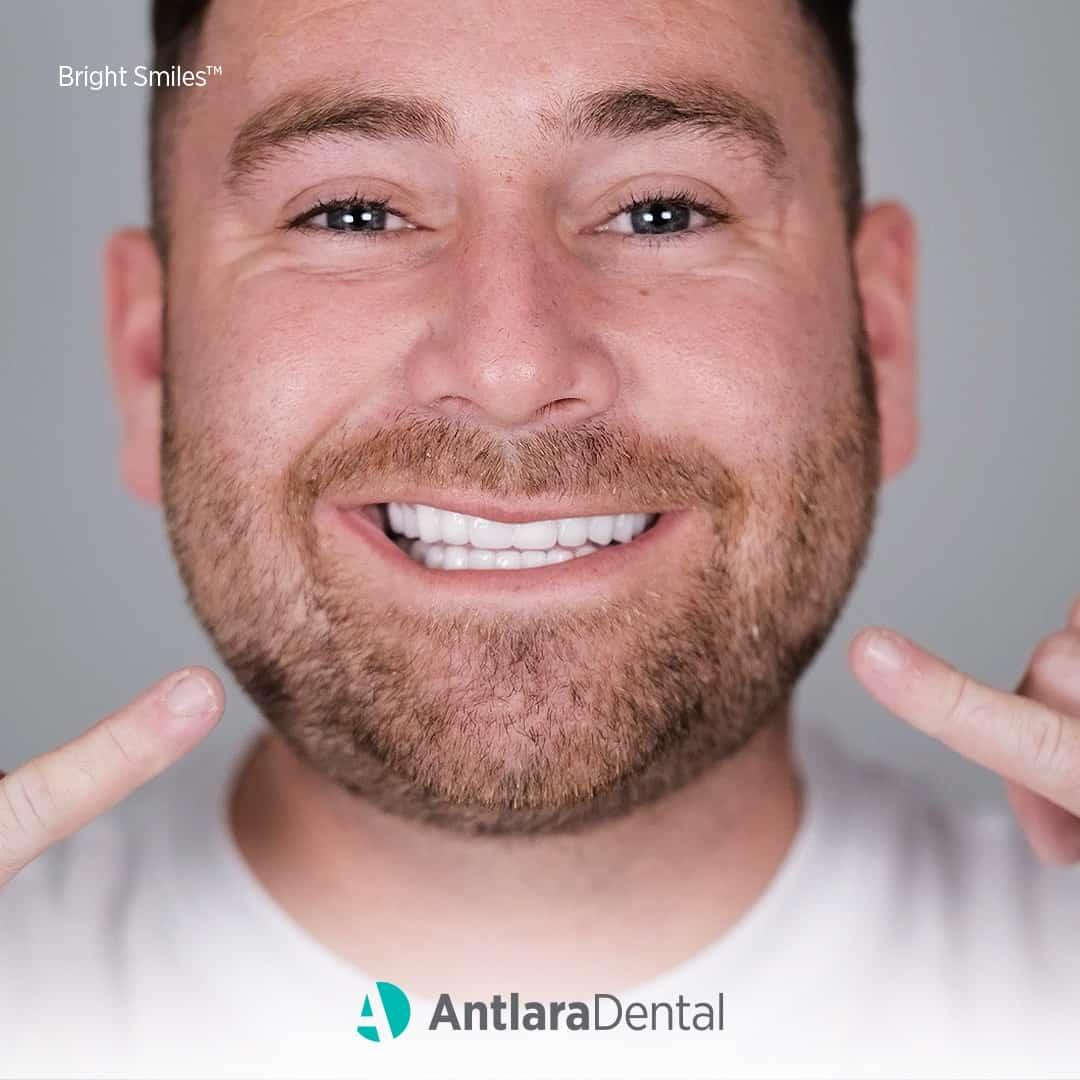 The smile of a patient who has had smile makeover treatment