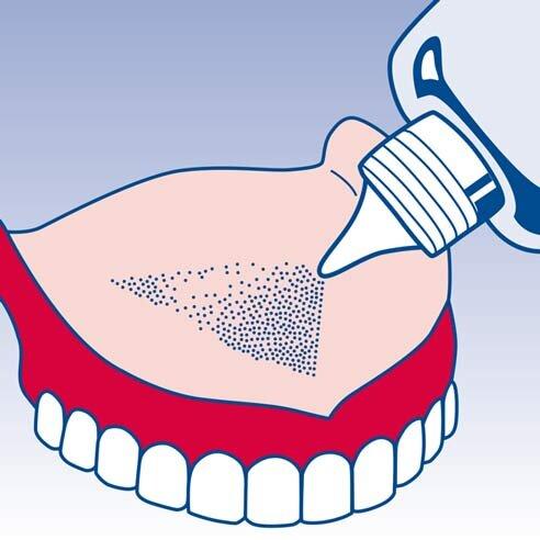 Illustration of adhesive powder sprinkled onto a denture