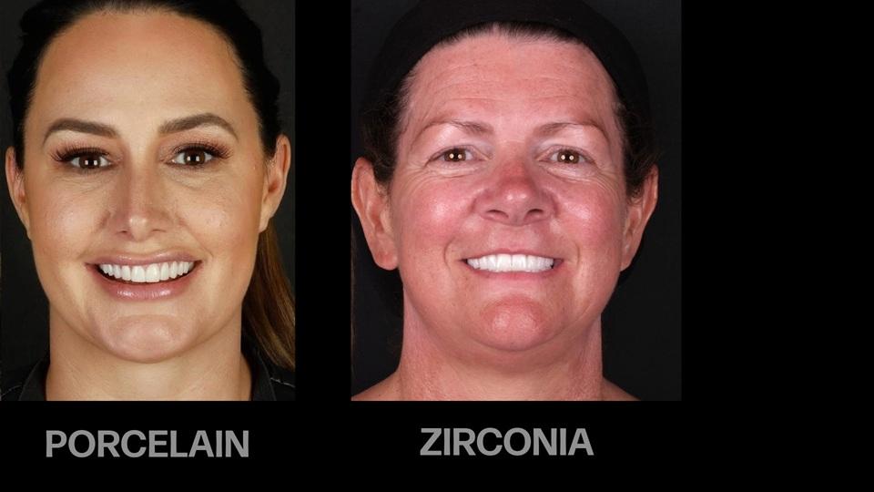 Portraits of two smiling women labelled porcelain and zirconia