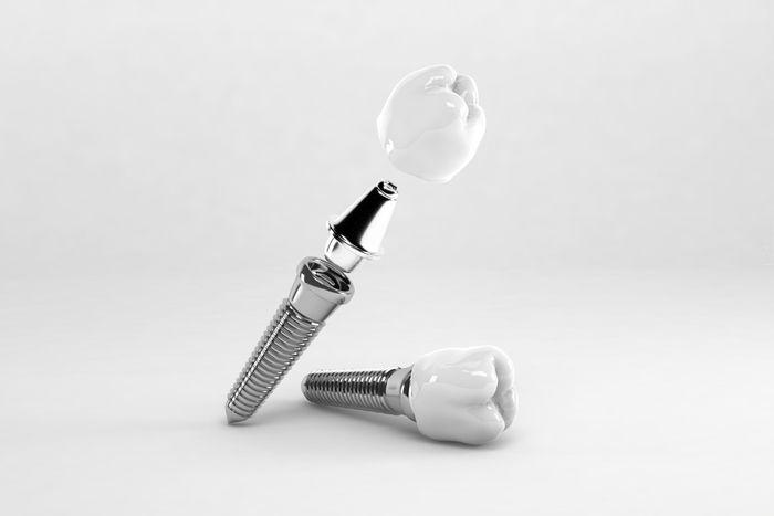 3D render of an implant, abutment and crown shown apart