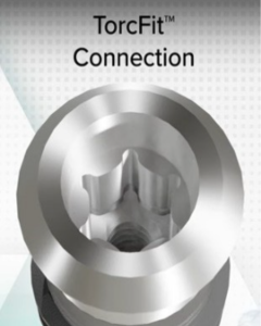Top view of an implant connection with a star-shaped socket