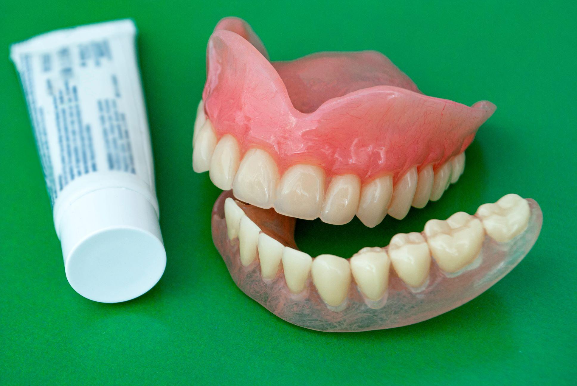 Upper and lower dentures beside a tube of adhesive cream