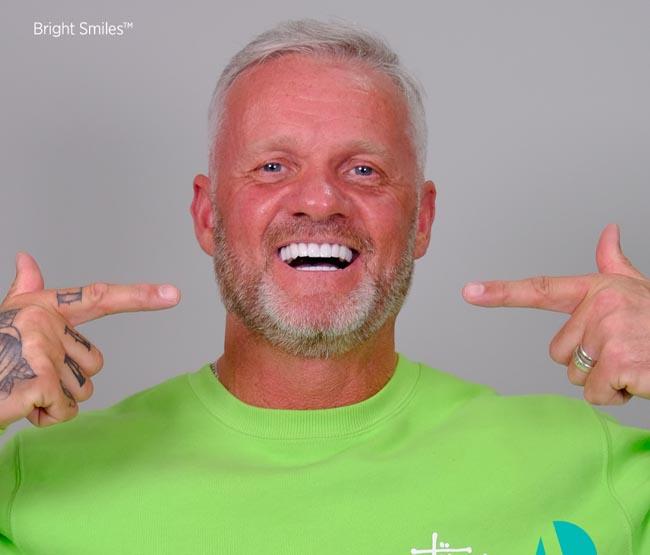 Smiling man pointing at his new teeth