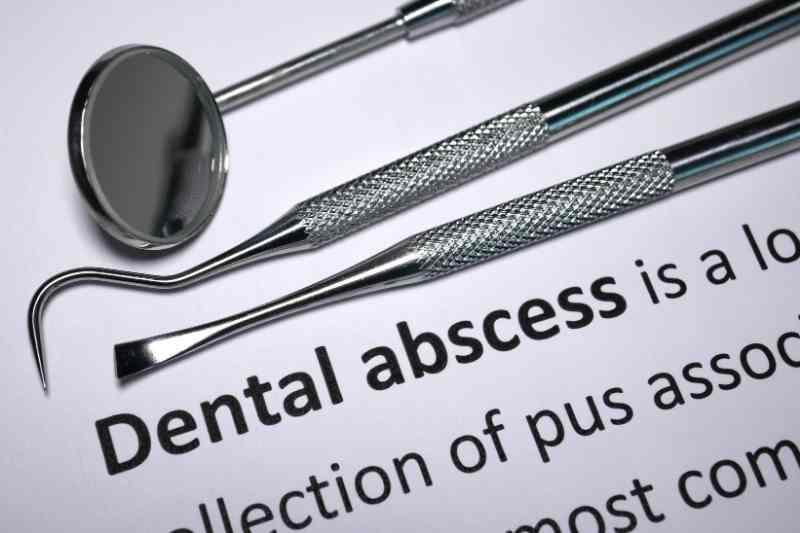 Dental mirror and probes on a printed definition of dental abscess