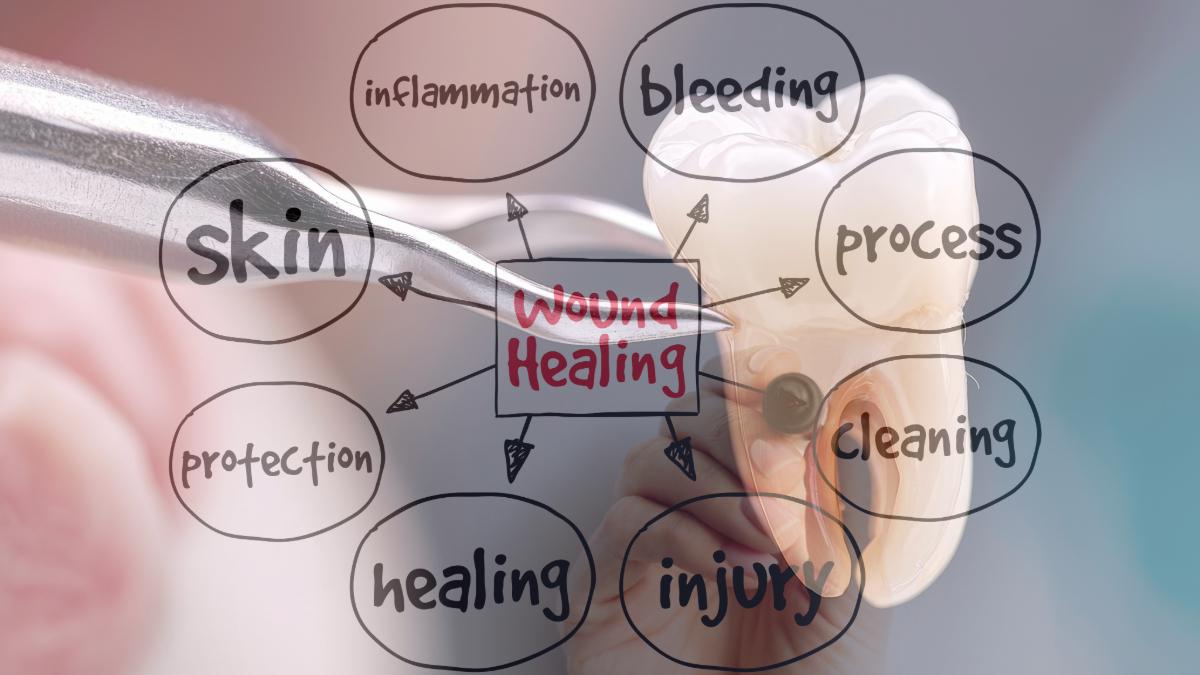 Extraction forceps and a molar overlaid with a wound healing concept map