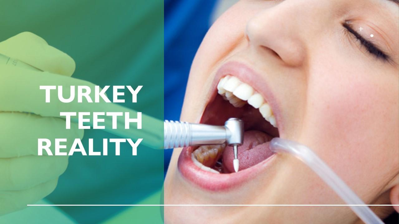 Turkey teeth before after