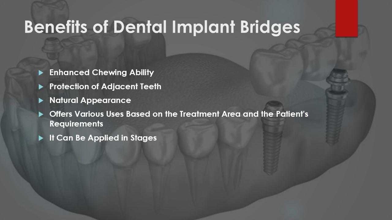 Slide listing benefits of implant bridges over a grey jaw model