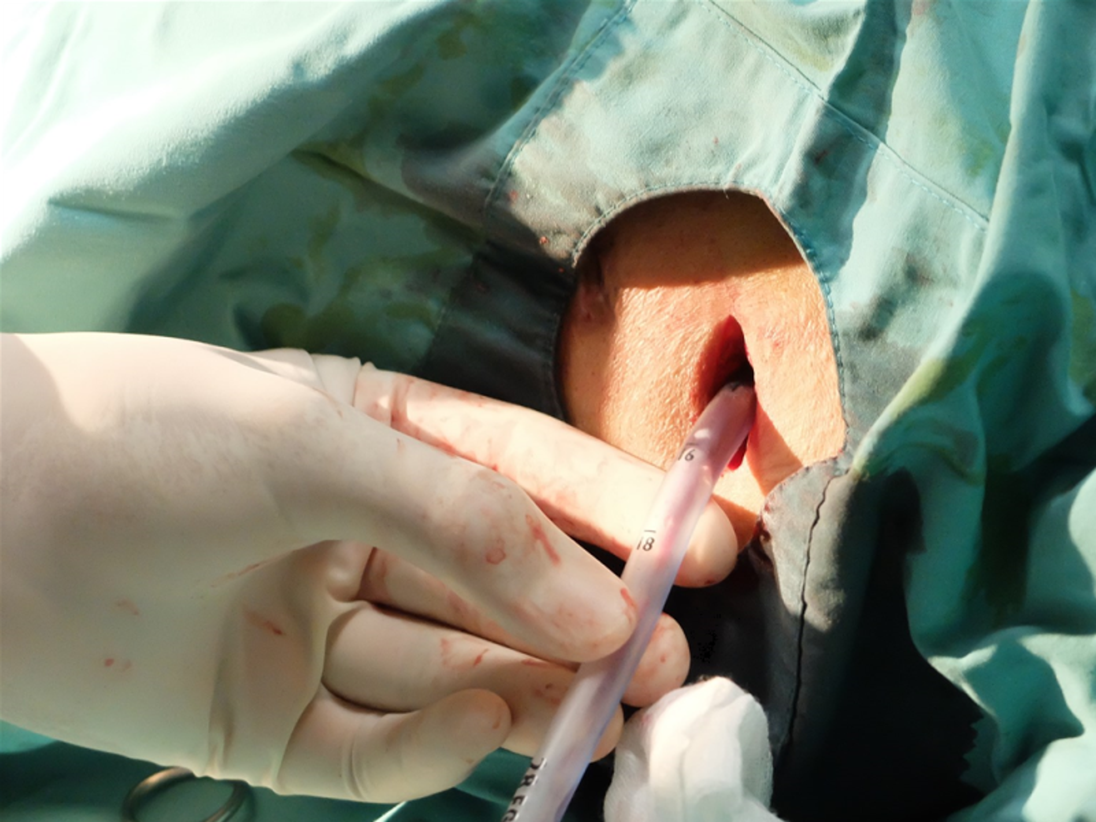 Cardiothoracic Surgery