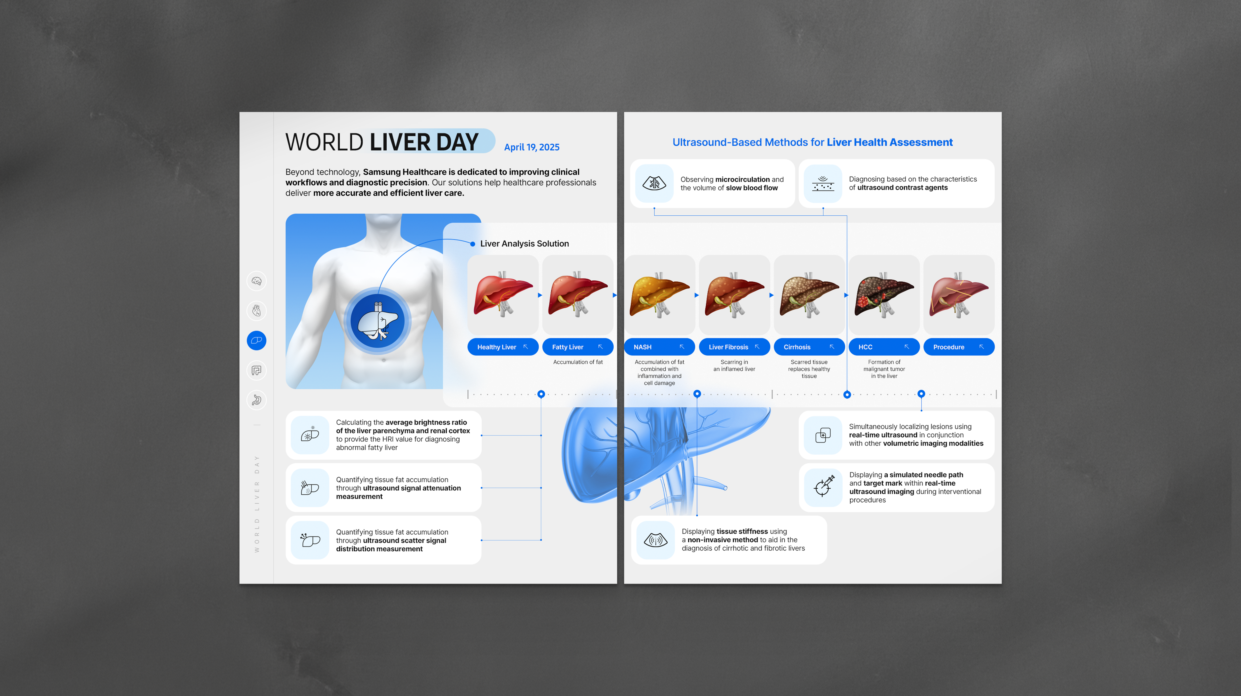 Samsung Healthcare - World liver day​​​​‌﻿‍﻿​‍​‍‌‍﻿﻿‌﻿​‍‌‍‍‌‌‍‌﻿‌‍‍‌‌‍﻿‍​‍​‍​﻿‍‍​‍​‍‌﻿​﻿‌‍​‌‌‍﻿‍‌‍‍‌‌﻿‌​‌﻿‍‌​‍﻿‍‌‍‍‌‌‍﻿﻿​‍​‍​‍﻿​​‍​‍‌‍‍​‌﻿​‍‌‍‌‌‌‍‌‍​‍​‍​﻿‍‍​‍​‍‌‍‍​‌﻿‌​‌﻿‌​‌﻿​​‌﻿​﻿​﻿‍‍​‍﻿﻿​‍﻿﻿‌‍​﻿‌﻿​‍​‍﻿‍‌﻿​﻿‌‍​‌‌‍﻿‍‌‍‍‌‌﻿‌​‌﻿‍‌​‍﻿‍‌﻿​﻿‌﻿‌​‌﻿‌‌‌‍‌​‌‍‍‌‌‍﻿﻿​‍﻿﻿‌﻿​﻿‌﻿‌​‌﻿‌‌‌‍‌​‌‍‍‌‌‍﻿﻿​‍﻿﻿‌‍‍‌‌‍﻿‍‌﻿‌​‌‍‌‌‌‍﻿‍‌﻿‌​​‍﻿﻿‌‍‌‌‌‍‌​‌‍‍‌‌﻿‌​​‍﻿﻿‌‍﻿‌‌‍﻿﻿‌‍‌​‌‍‌‌​﻿﻿‌‌﻿​​‌﻿​‍‌‍‌‌‌﻿​﻿‌‍‌‌‌‍﻿‍‌﻿‌​‌‍​‌‌﻿‌​‌‍‍‌‌‍﻿﻿‌‍﻿‍​﻿‍﻿‌‍‍‌‌‍‌​​﻿﻿‌​﻿​‌‌‍‌‍​﻿​‌​﻿‌​​﻿​‌​﻿‍‌‌‍​‌​﻿​‌​‍﻿‌​﻿​‌​﻿‌​​﻿‌‌​﻿​﻿​‍﻿‌​﻿‌​​﻿‌​​﻿​‌‌‍​‌​‍﻿‌‌‍​‍​﻿‌﻿​﻿‌​​﻿‍‌​‍﻿‌‌‍‌​​﻿‌‌​﻿‍​‌‍‌‍​﻿​‌‌‍‌‌‌‍​‍​﻿​﻿‌‍​﻿​﻿‌​​﻿‌‍​﻿‍‌​﻿‍﻿‌﻿‌​‌﻿‍‌‌﻿​​‌‍‌‌​﻿﻿‌‌﻿​​‌﻿​‍‌‍﻿﻿‌‍‍‍‌‍‌‌‌‍​﻿‌﻿‌​​﻿‍﻿‌﻿​​‌‍​‌‌﻿‌​‌‍‍​​﻿﻿‌‌﻿‌​‌‍‍‌‌﻿‌​‌‍﻿​‌‍‌‌​﻿﻿﻿‌‍​‍‌‍​‌‌﻿​﻿‌‍‌‌‌‌‌‌‌﻿​‍‌‍﻿​​﻿﻿‌‌‍‍​‌﻿‌​‌﻿‌​‌﻿​​‌﻿​﻿​‍‌‌​﻿​﻿‌​​‌​‍‌‌​﻿​‍‌​‌‍​‍‌‌​﻿​‍‌​‌‍‌‍​﻿‌﻿​‍​‍﻿‍‌﻿​﻿‌‍​‌‌‍﻿‍‌‍‍‌‌﻿‌​‌﻿‍‌​‍﻿‍‌﻿​﻿‌﻿‌​‌﻿‌‌‌‍‌​‌‍‍‌‌‍﻿﻿​‍‌‌​﻿​‍‌​‌‍‌﻿​﻿‌﻿‌​‌﻿‌‌‌‍‌​‌‍‍‌‌‍﻿﻿​‍‌‍‌‍‍‌‌‍‌​​﻿﻿‌​﻿​‌‌‍‌‍​﻿​‌​﻿‌​​﻿​‌​﻿‍‌‌‍​‌​﻿​‌​‍﻿‌​﻿​‌​﻿‌​​﻿‌‌​﻿​﻿​‍﻿‌​﻿‌​​﻿‌​​﻿​‌‌‍​‌​‍﻿‌‌‍​‍​﻿‌﻿​﻿‌​​﻿‍‌​‍﻿‌‌‍‌​​﻿‌‌​﻿‍​‌‍‌‍​﻿​‌‌‍‌‌‌‍​‍​﻿​﻿‌‍​﻿​﻿‌​​﻿‌‍​﻿‍‌​‍‌‍‌﻿‌​‌﻿‍‌‌﻿​​‌‍‌‌​﻿﻿‌‌﻿​​‌﻿​‍‌‍﻿﻿‌‍‍‍‌‍‌‌‌‍​﻿‌﻿‌​​‍‌‍‌﻿​​‌‍​‌‌﻿‌​‌‍‍​​﻿﻿‌‌﻿‌​‌‍‍‌‌﻿‌​‌‍﻿​‌‍‌‌​‍‌‍‌﻿​​‌‍‌‌‌﻿​‍‌﻿​﻿‌﻿​​‌‍‌‌‌‍​﻿‌﻿‌​‌‍‍‌‌﻿‌‍‌‍‌‌​﻿﻿‌‌﻿​​‌﻿‌‌‌‍​‍‌‍﻿​‌‍‍‌‌﻿​﻿‌‍‍​‌‍‌‌‌‍‌​​‍​‍‌﻿﻿‌
