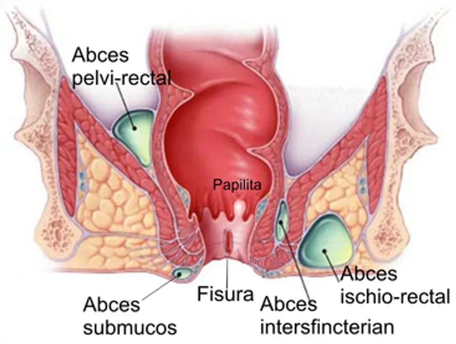 Fispat