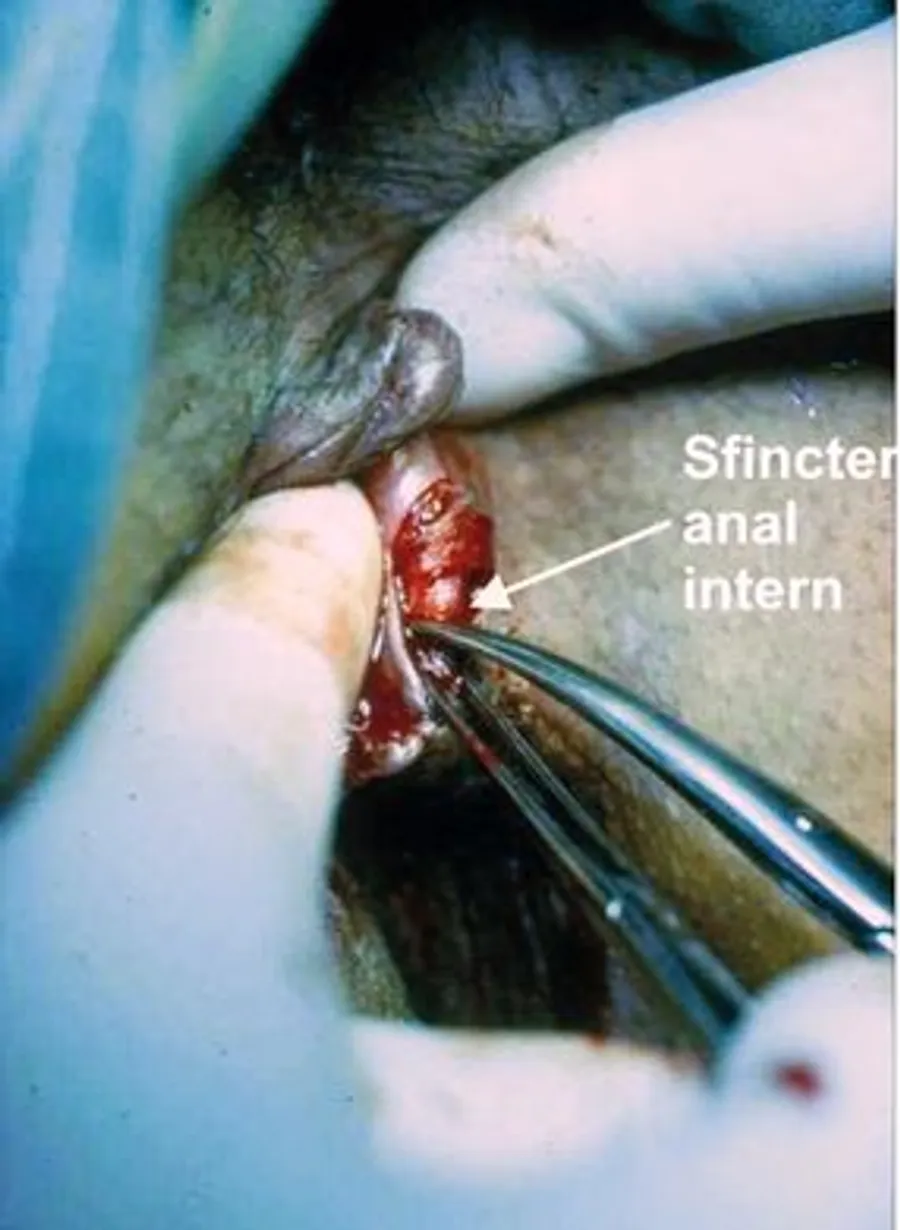 Sfincteranalintern
