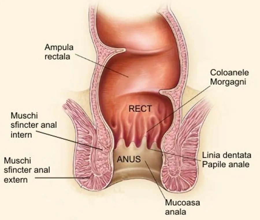 Antorect