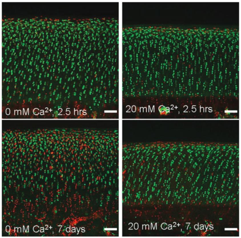 Extracellular Calcium Modulates Early and Delayed Chondrocyte Loss