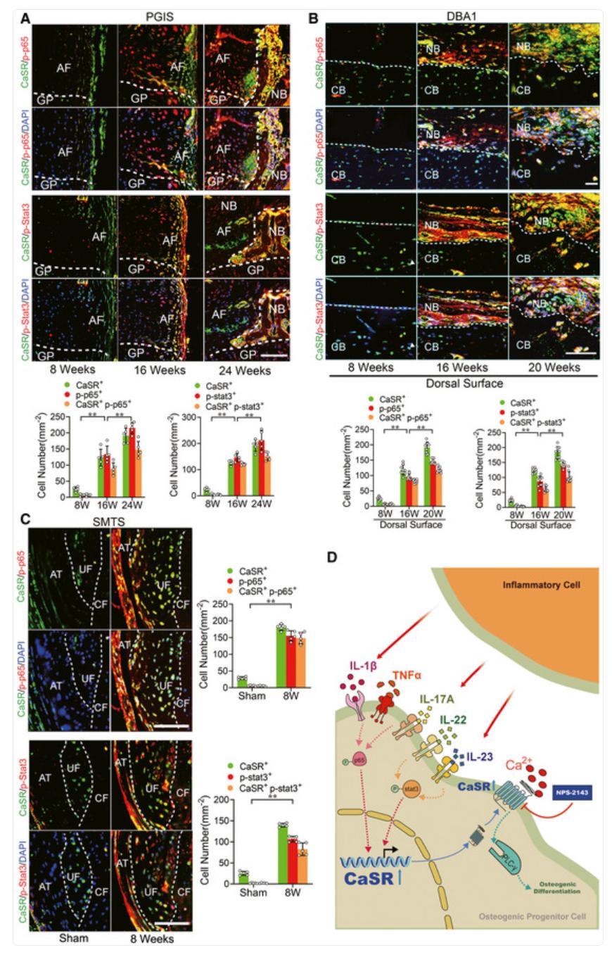Inflammation drives abnormal bone formation through the calcium-sensing receptor