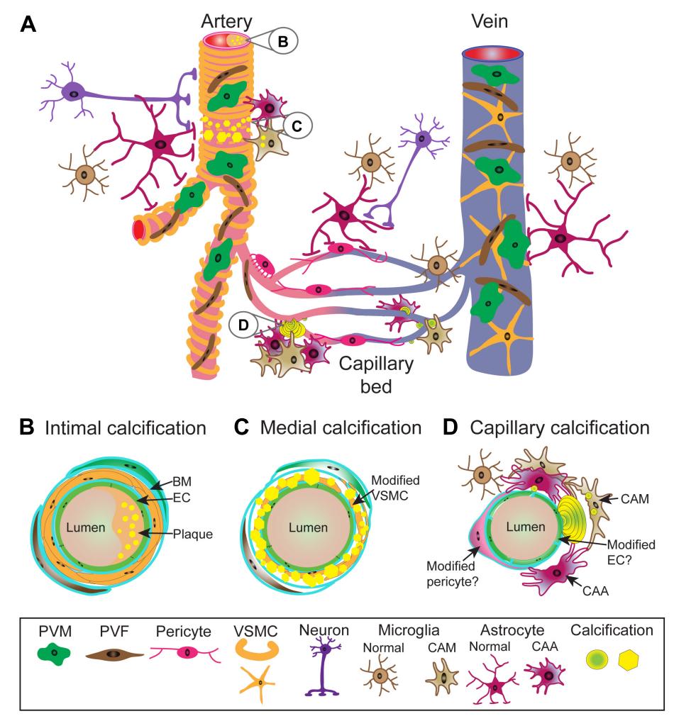 Schematic Overview of Vascular Calcifications in the Central Nervous System