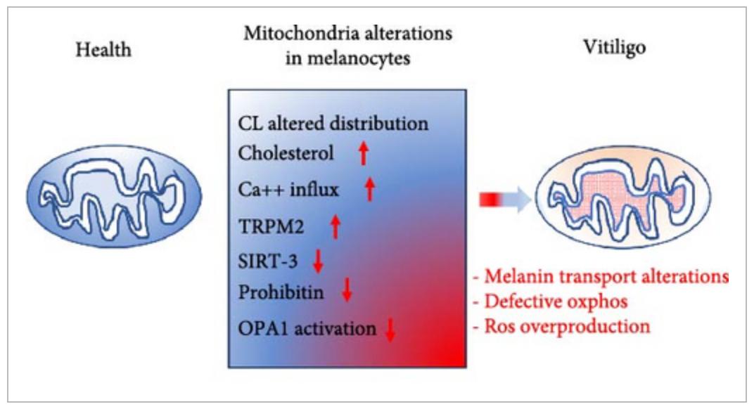 Mitochondrial Oxidative Phosphorylation Defects in Vitiligo Melanocytes