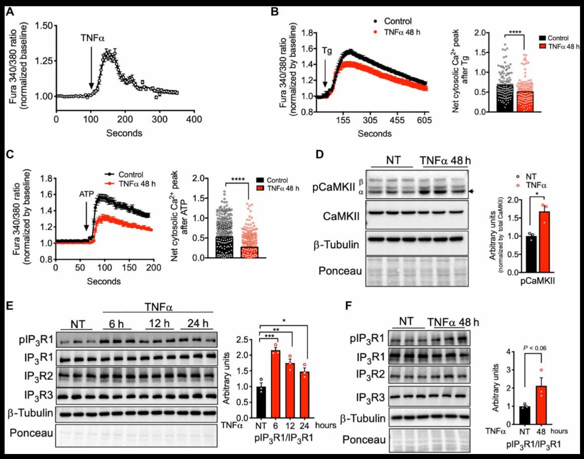 How Inflammation Rewires Calcium Signaling Inside Fat Cells