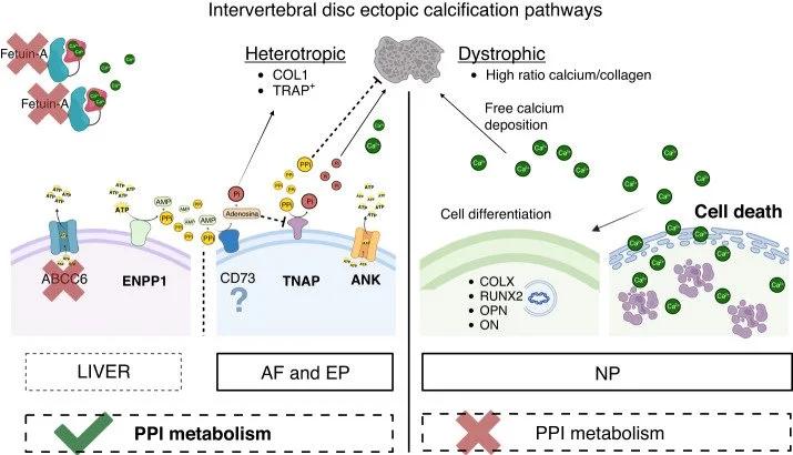 Intervertebral disc ectopic calcification pathway