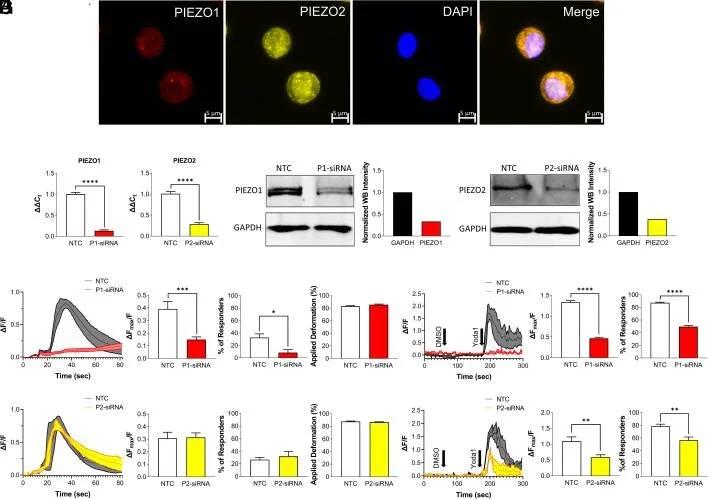 Calcium Entry via PIEZO1/2 in Joint Cells