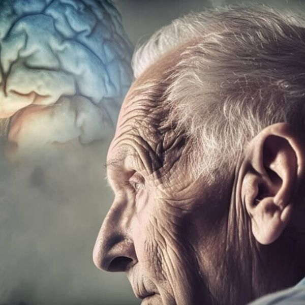 ใครเสี่ยงเป็นอัลไซเมอร์