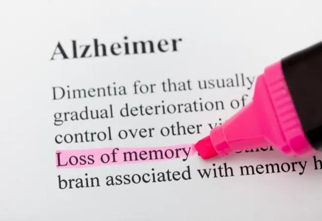 วิธีรักษา โรคอัลไซเมอร์
