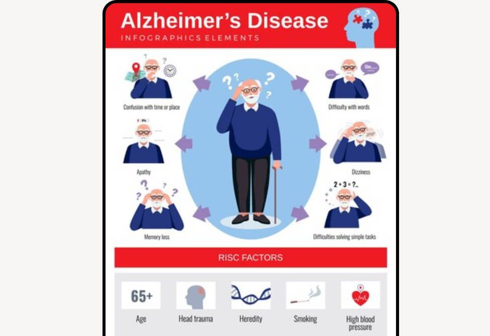 อัลไซเมอร์ อาการยังไง