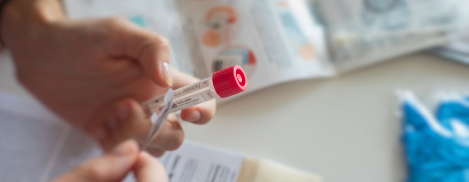 person putting the label on an at-home medical test 