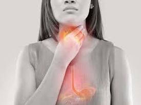 A woman who has acid reflux touching her throat