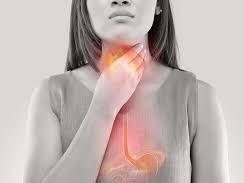 A woman who has acid reflux touching her throat