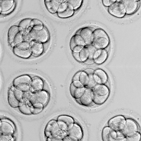 Linda: “We have donated our embryos to people we don't know”
