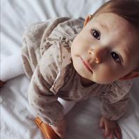 “People ask me what my daughter has on her head and whether it can still be removed”