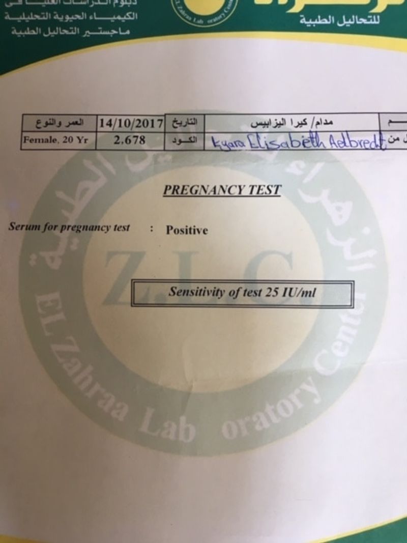 Missing alt text