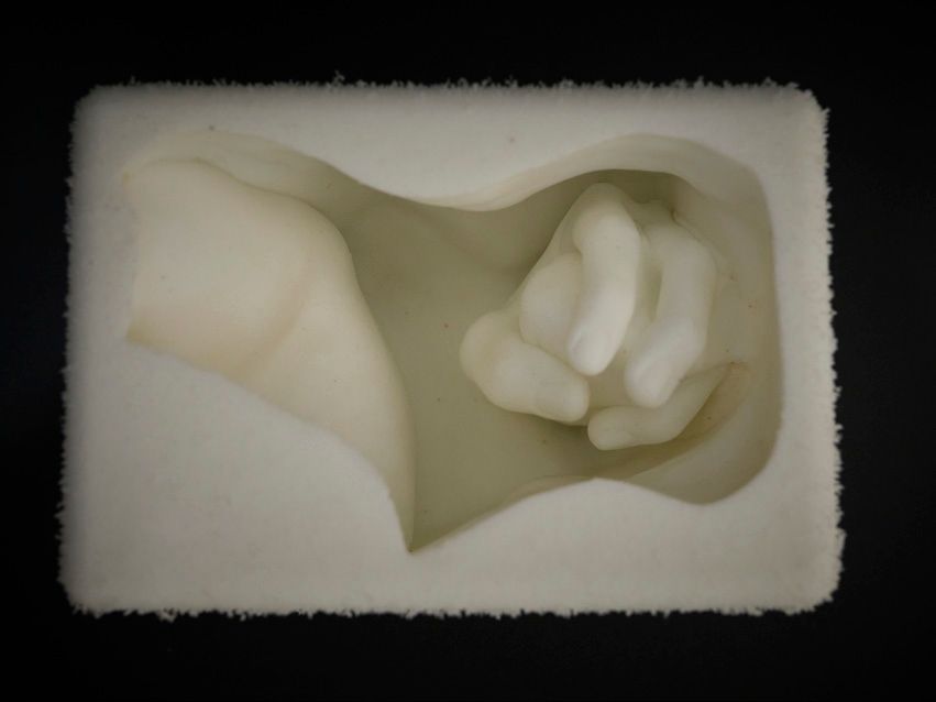 4. Agujero (entre mano con piedra y pliegue de cuello con hombro)-1