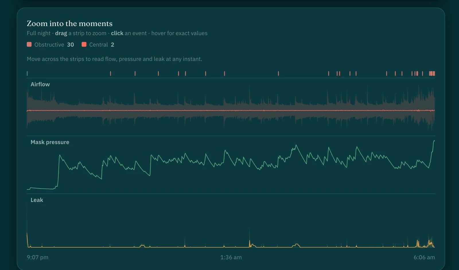 Breath-by-breath waveform viewer