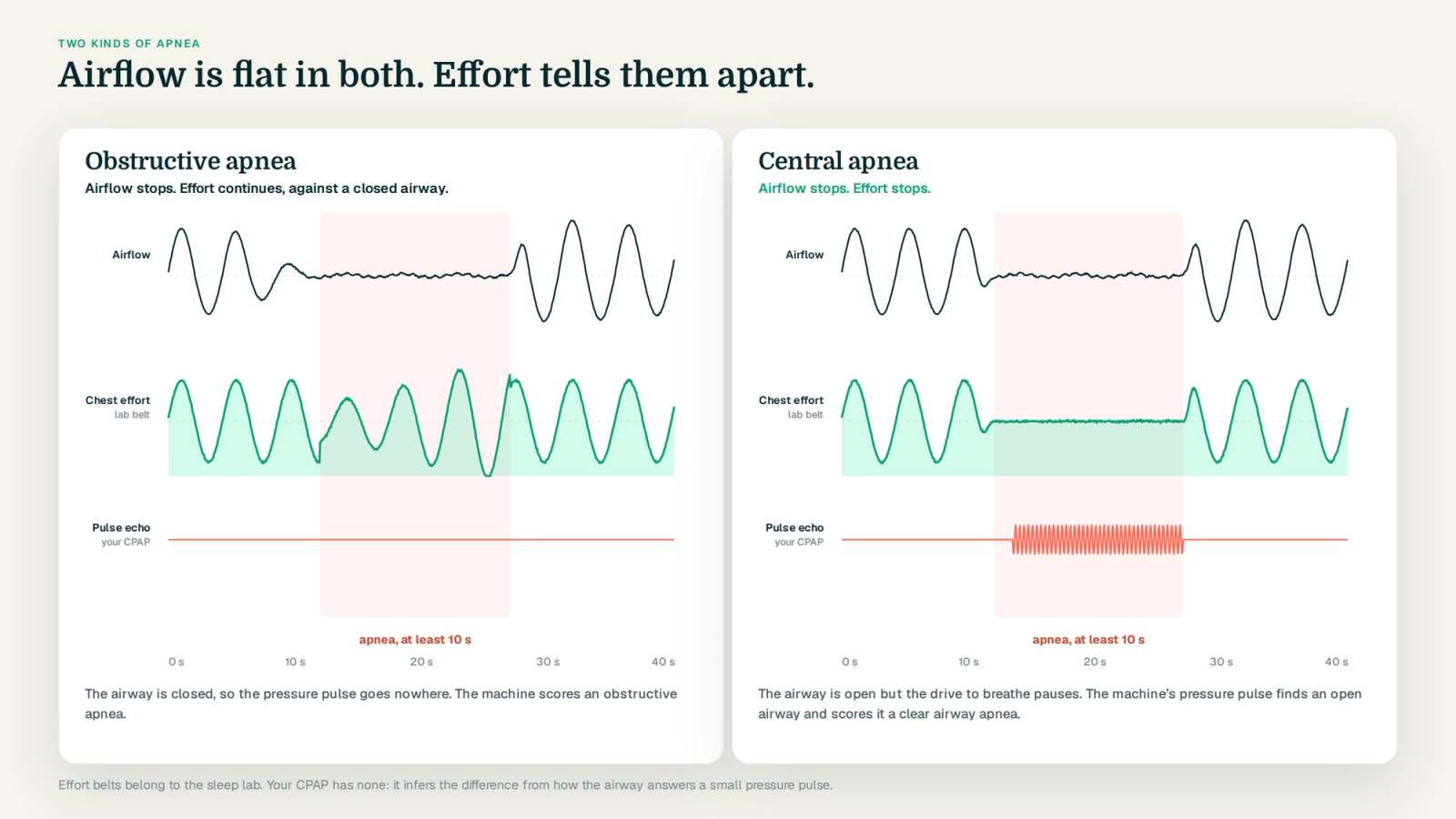 Side-by-side panels of an obstructive and a central apnea: airflow is flat in both; the chest effort band continues in the obstructive event and is absent in the central one; the pressure pulse echo is flat for obstructive and present for central