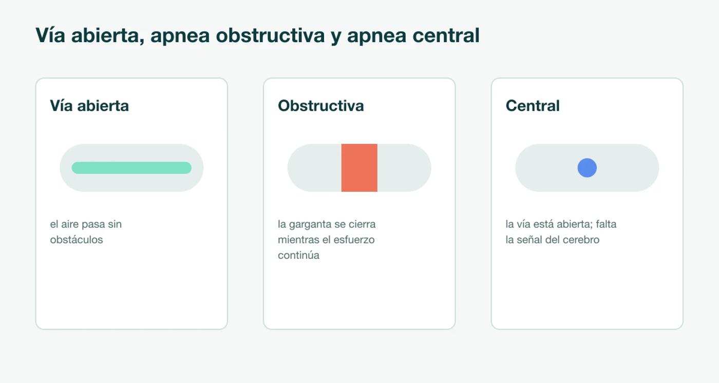 Tres diagramas de la vía respiratoria: vía abierta, apnea obstructiva (la garganta se cierra mientras el esfuerzo por respirar continúa) y apnea central (la vía está abierta pero el cerebro no envía la señal de respirar)