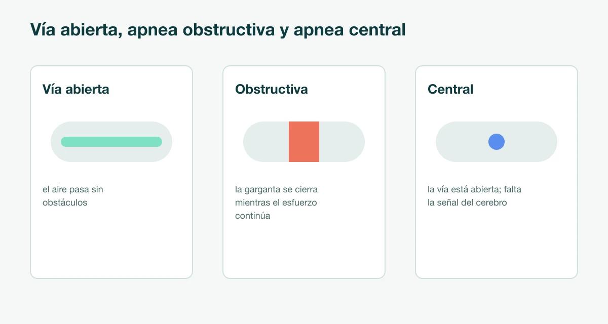 Tres diagramas de la vía respiratoria: vía abierta, apnea obstructiva (la garganta se cierra mientras el esfuerzo por respirar continúa) y apnea central (la vía está abierta pero el cerebro no envía la señal de respirar)