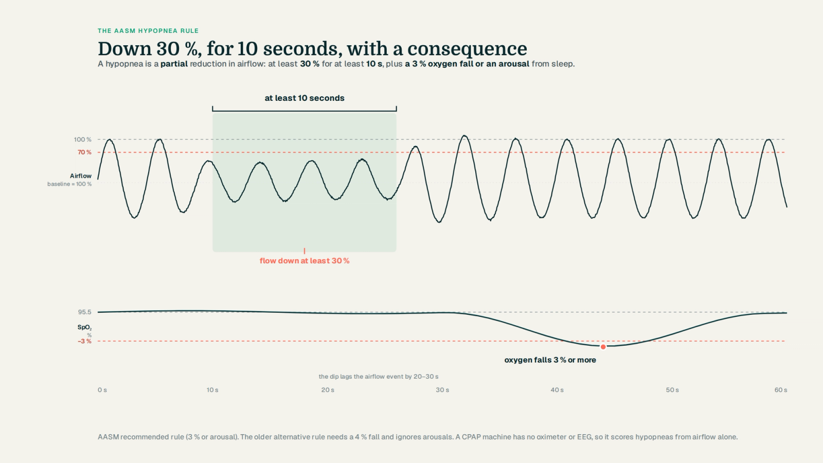 Airflow trace with a 30 percent drop held for at least 10 seconds and the SpO2 trace below falling 3 percent about 20 to 30 seconds later, illustrating the AASM hypopnea rule