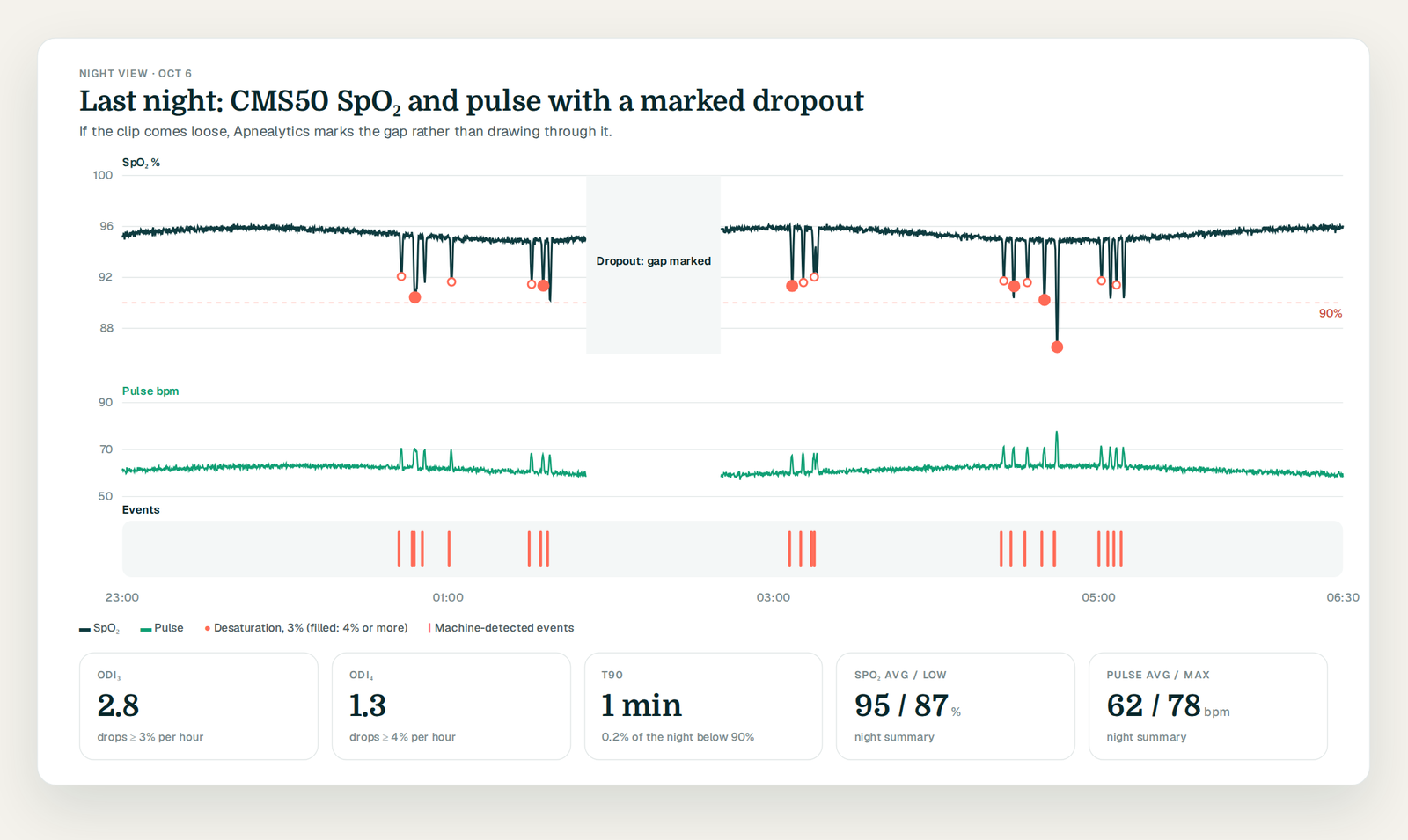 SpO2 and pulse overlay with a marked dropout gap and ODI and T90 tiles