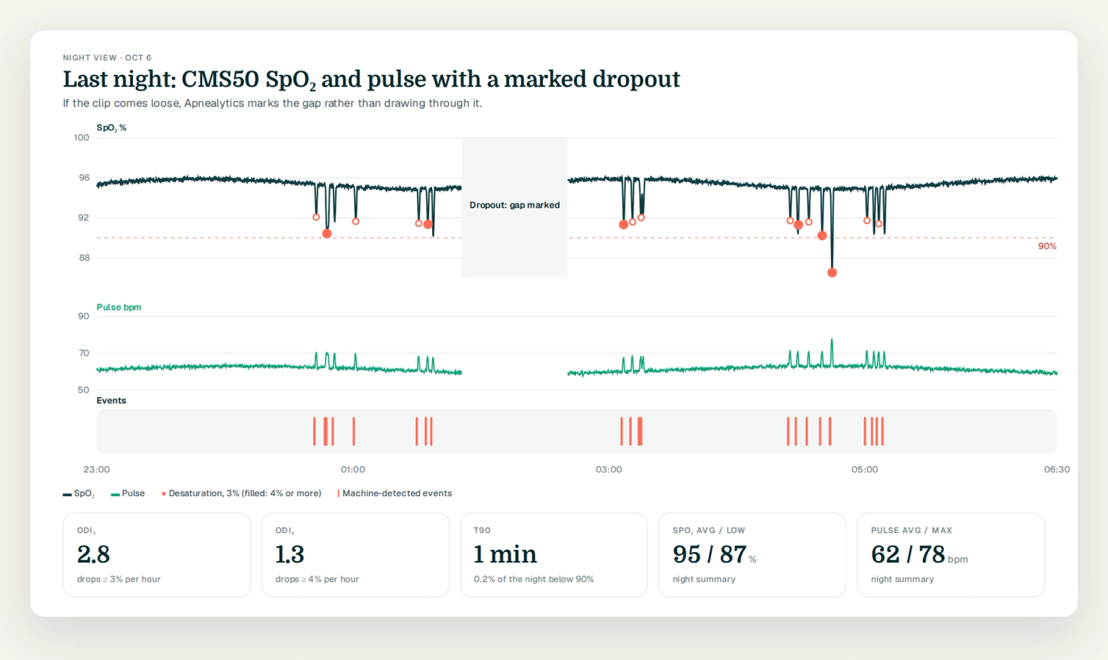 SpO2 and pulse overlay with a marked dropout gap and ODI and T90 tiles