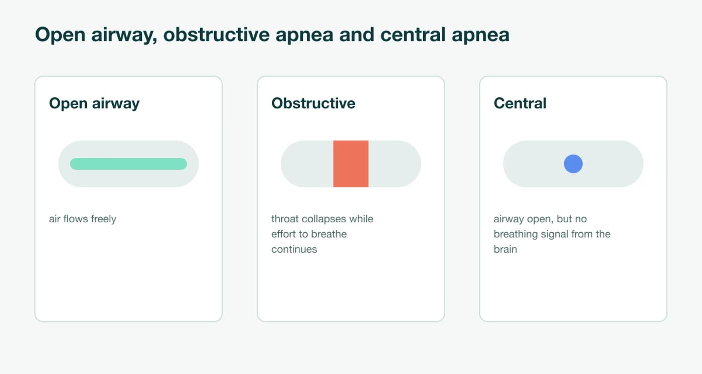 Three airway diagrams: an open airway, an obstructive apnea where the throat collapses while the breathing effort continues, and a central apnea where the airway is open but the brain sends no breathing signal