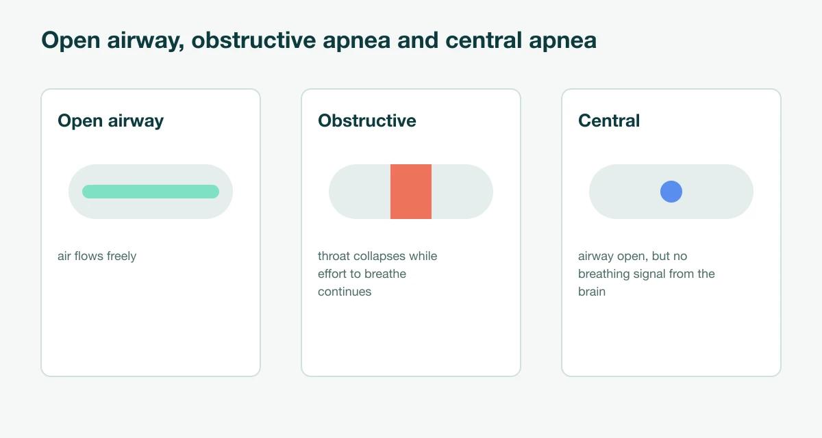Three airway diagrams: an open airway, an obstructive apnea where the throat collapses while the breathing effort continues, and a central apnea where the airway is open but the brain sends no breathing signal