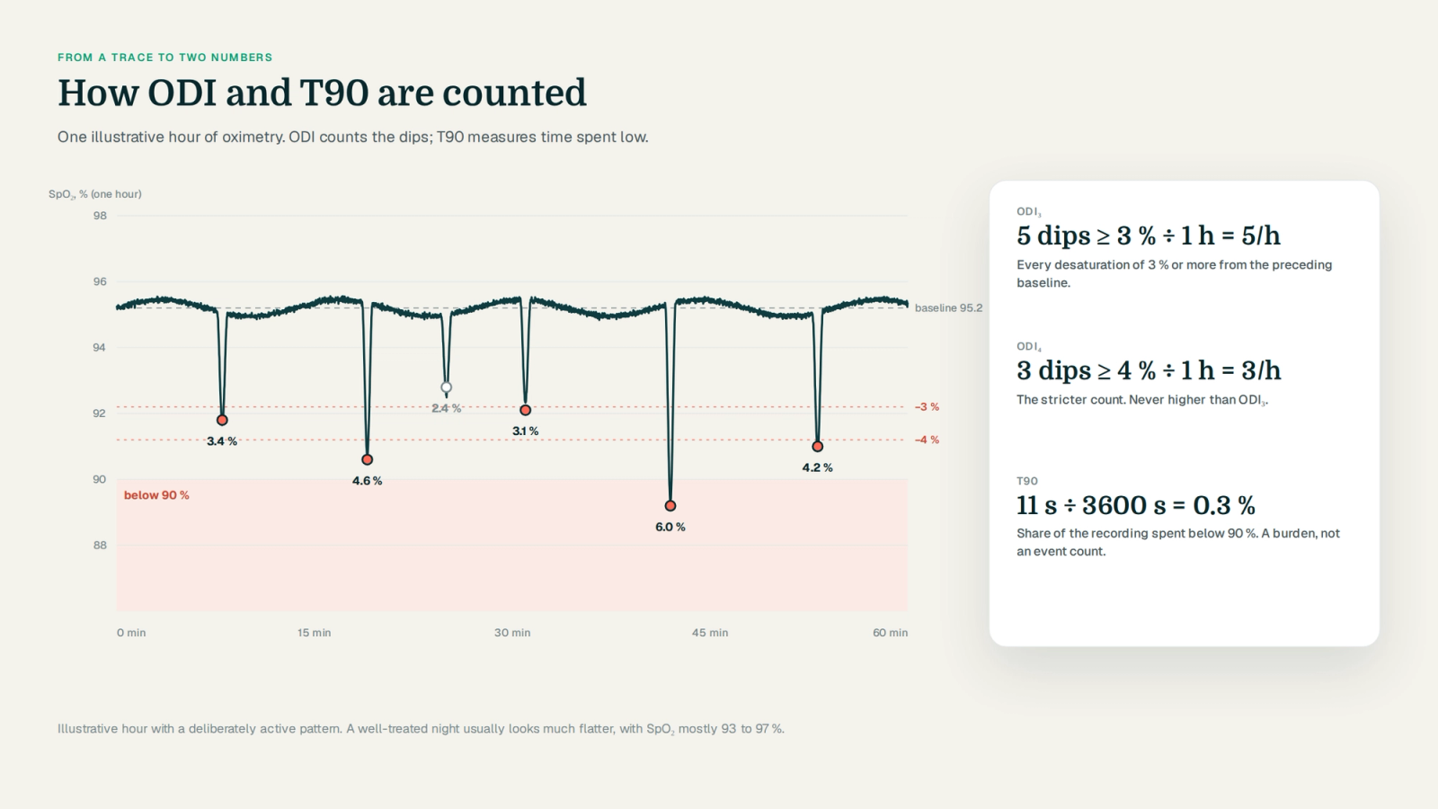 One hour of SpO2 with six dips marked, five of at least 3 percent and three of at least 4 percent, a shaded region below 90 percent, and the derivation ODI3 5 per hour, ODI4 3 per hour and T90 0.3 percent