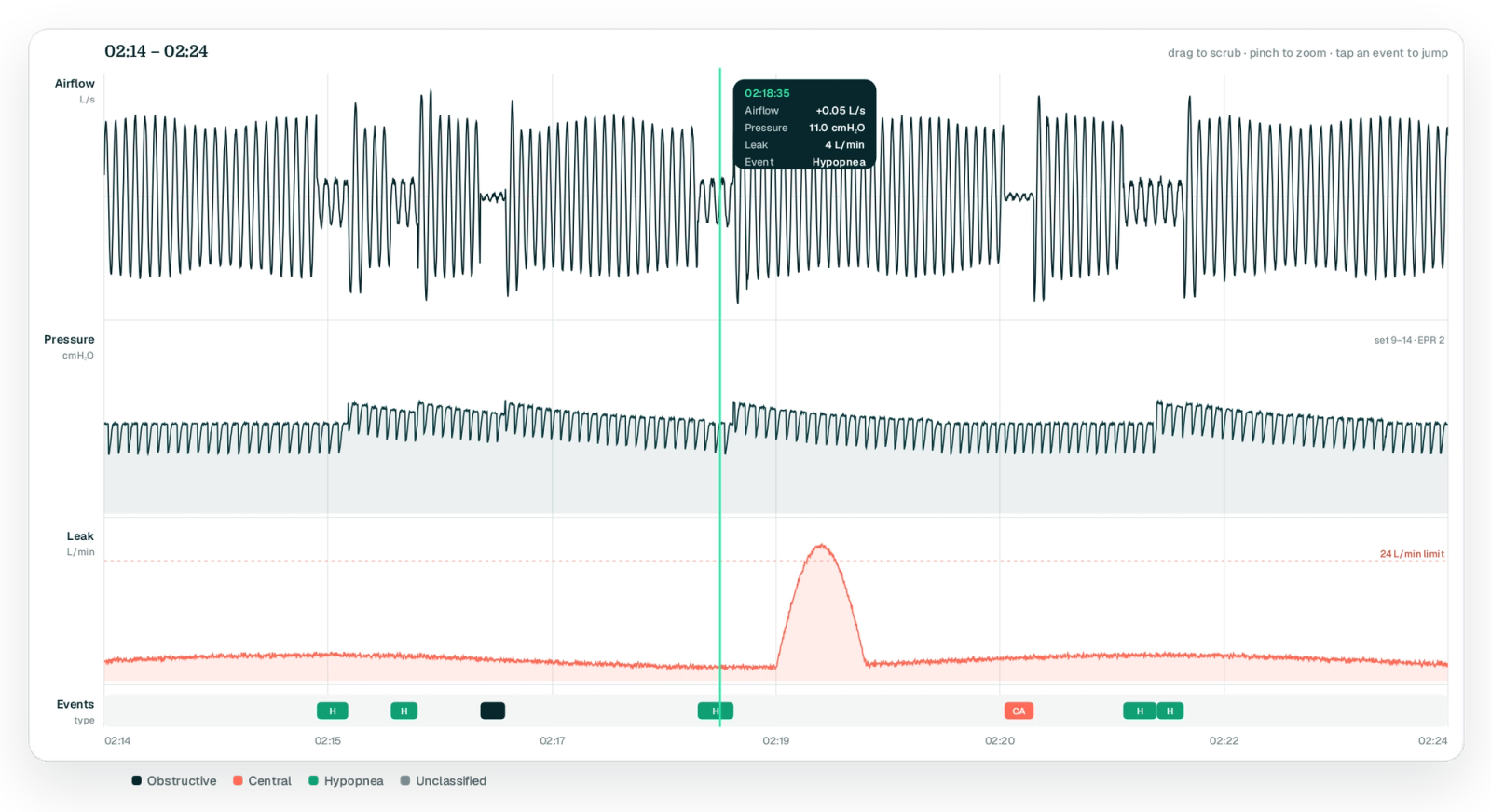 Four stacked aligned traces over a ten-minute window: airflow, pressure with EPR exhale drops, leak with a bump near the 24 L/min line, event strip with OA/CA/H markers; crosshair tooltip with values at 02:18:35