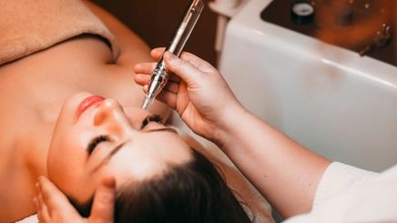 Woman closing her eyes during microneedling session at an aesthetic clinic.