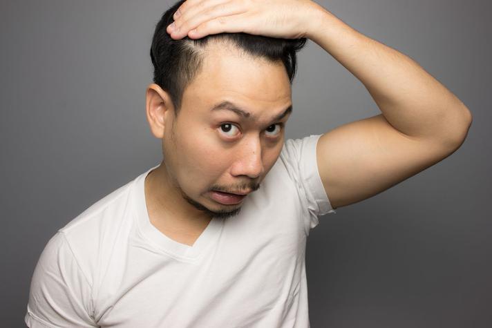 What to Do About Hair Part Widening 