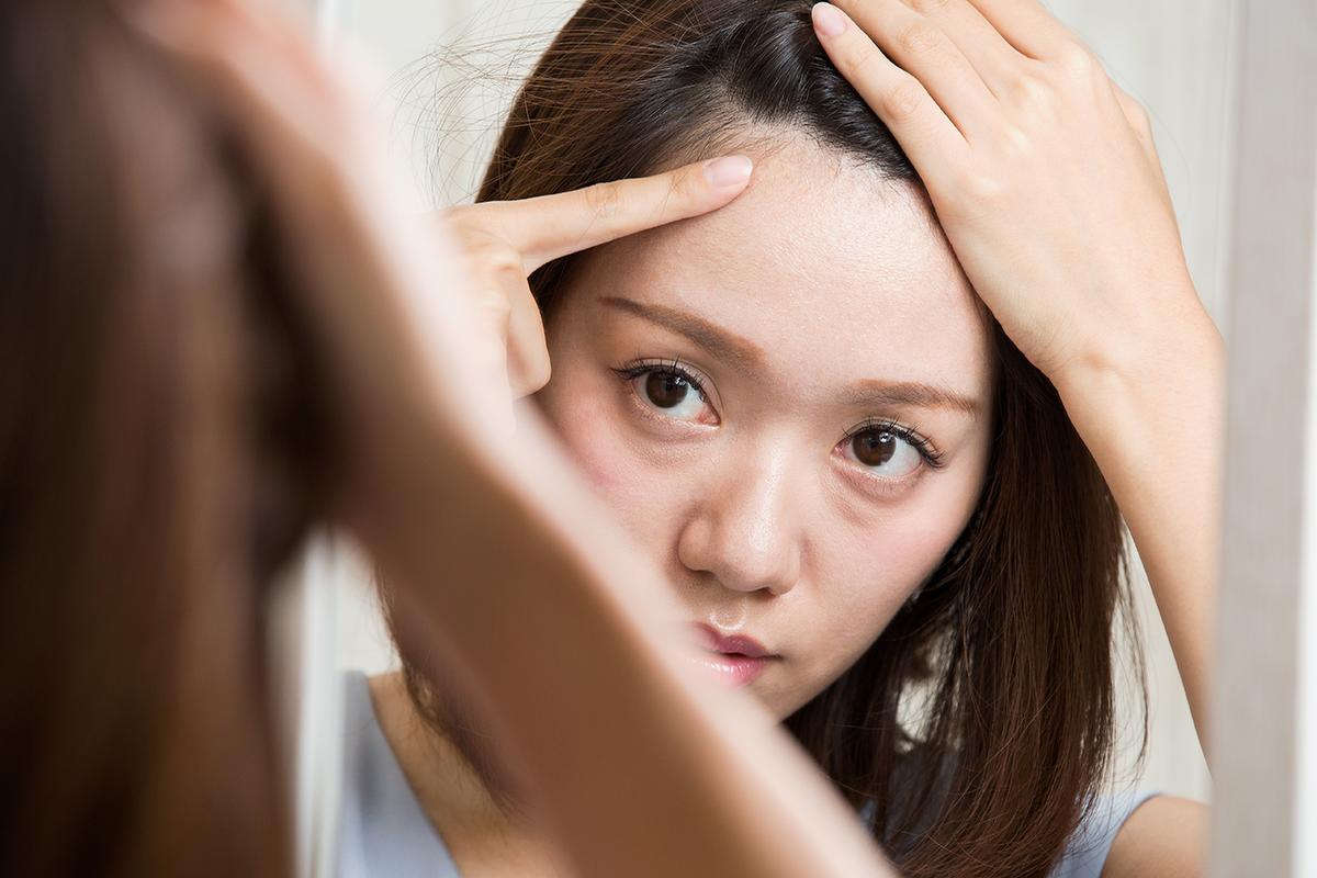 Scalp Acne: Prevention And Treatment | BeautyHub.PH