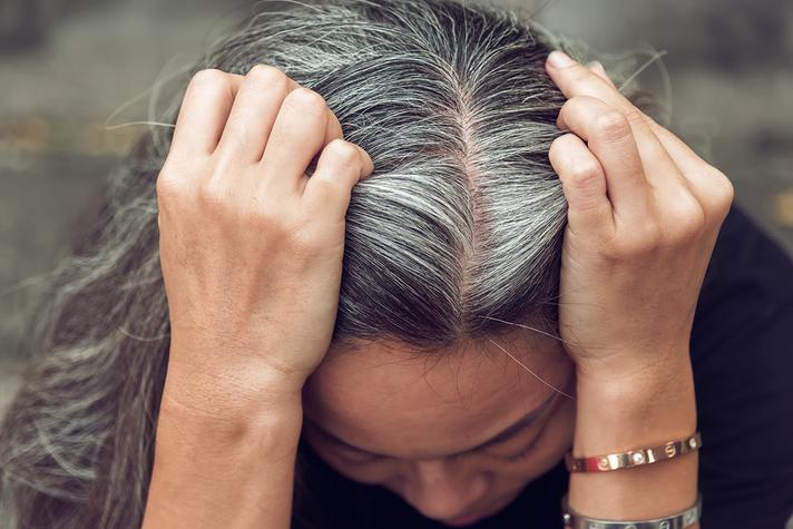 5 Surprising White Hair Causes 