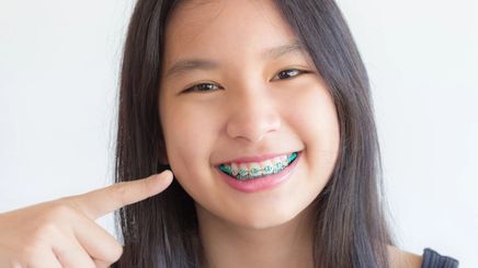 A woman smiling with braces